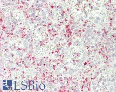 CXCL3 / GRO Gamma Antibody (aa35-107)