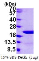 Human EIF1AY Protein (Recombinant His)