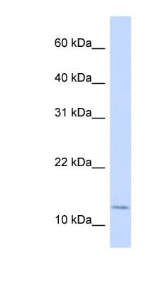 CRABP2 Antibody (aa72-121)