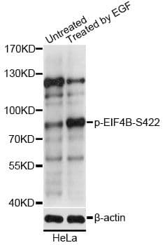 EIF4B Antibody (phospho-Ser422)
