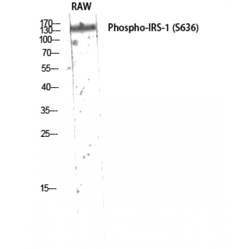 IRS1 Antibody (570-650 aa)