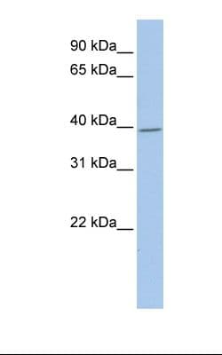 GNAI1 / Gi Antibody (aa146-195)