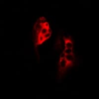 SCYL1 / NTKL Antibody
