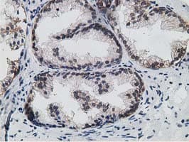Monoclonal Mouse anti-Human 15-PGDH / HPGD Antibody (clone OTI1E9, IHC, WB)