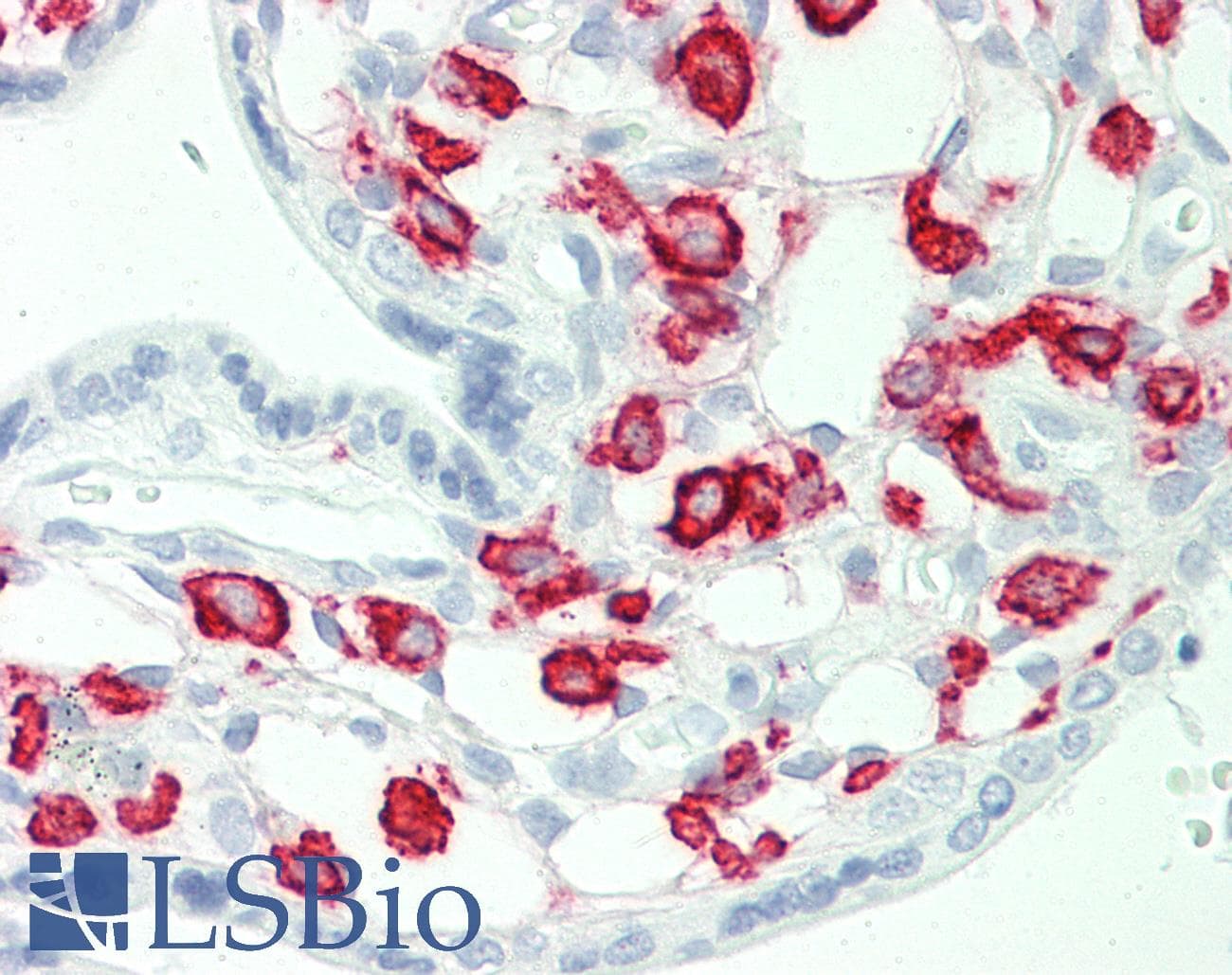 IHC-plus™ CD32A Antibody (clone 13D7)