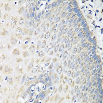 Polyclonal Rabbit anti-Human OXCT1 Antibody (IHC, WB)