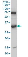Monoclonal Mouse anti-Human MPG Antibody (clone 2C5, IHC, IF, WB)