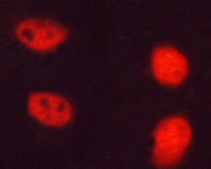 NPM1 / NPM / Nucleophosmin Antibody (phospho-Thr199)