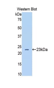 HP / Haptoglobin Antibody (aa123-307, Cy3)