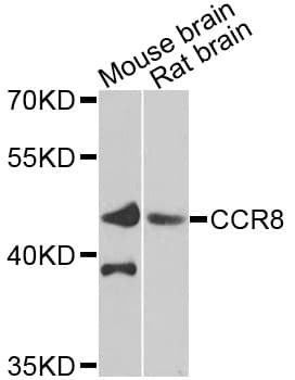 CCR8 / CD198 Antibody