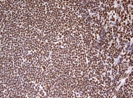 Monoclonal Mouse anti-Human HNRPM / HNRNPM Antibody (clone OTI3F3, aa1-261, IHC, WB)