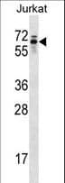 TROVE2 Antibody (aa467-495)