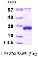 Human ARL5A / ARL5 Protein (Recombinant His)