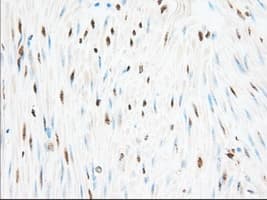 H6PD / G6PDH Antibody (clone OTI2A7)