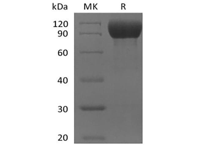 Mouse IL1RL2 Protein (Recombinant Fc, C-terminus)