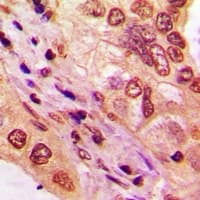TBX10 Antibody (Internal)