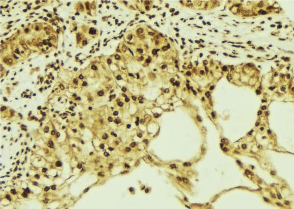 KPNA1 / Importin Alpha 5 Antibody