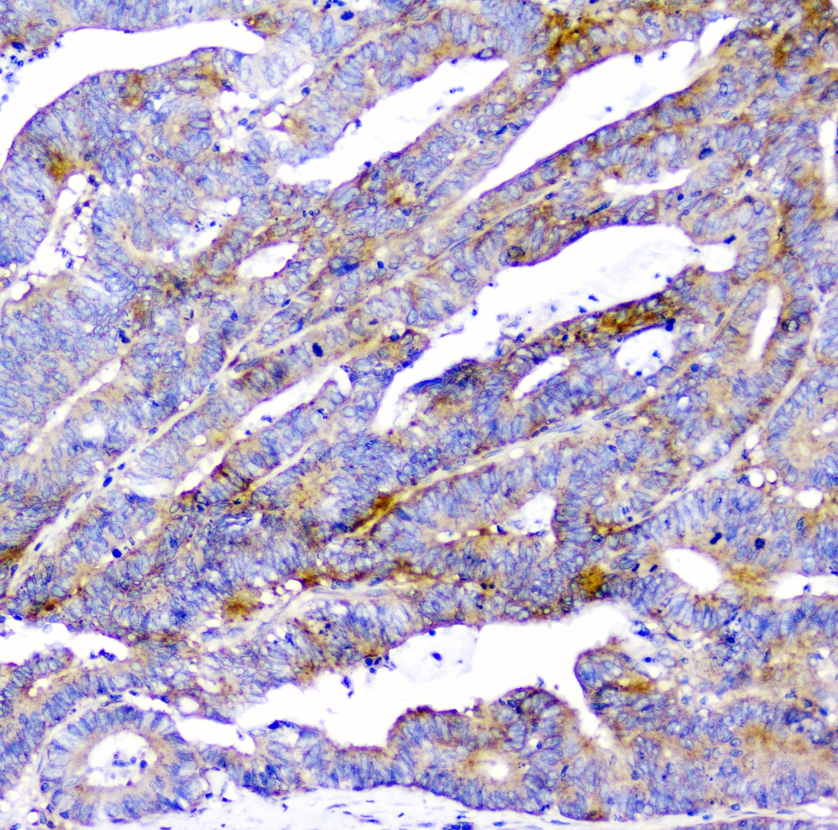 CD2AP Antibody