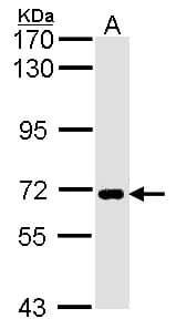 IHC-plus™ Polyclonal Rabbit anti-Human SLC20A1 Antibody (IHC, WB)