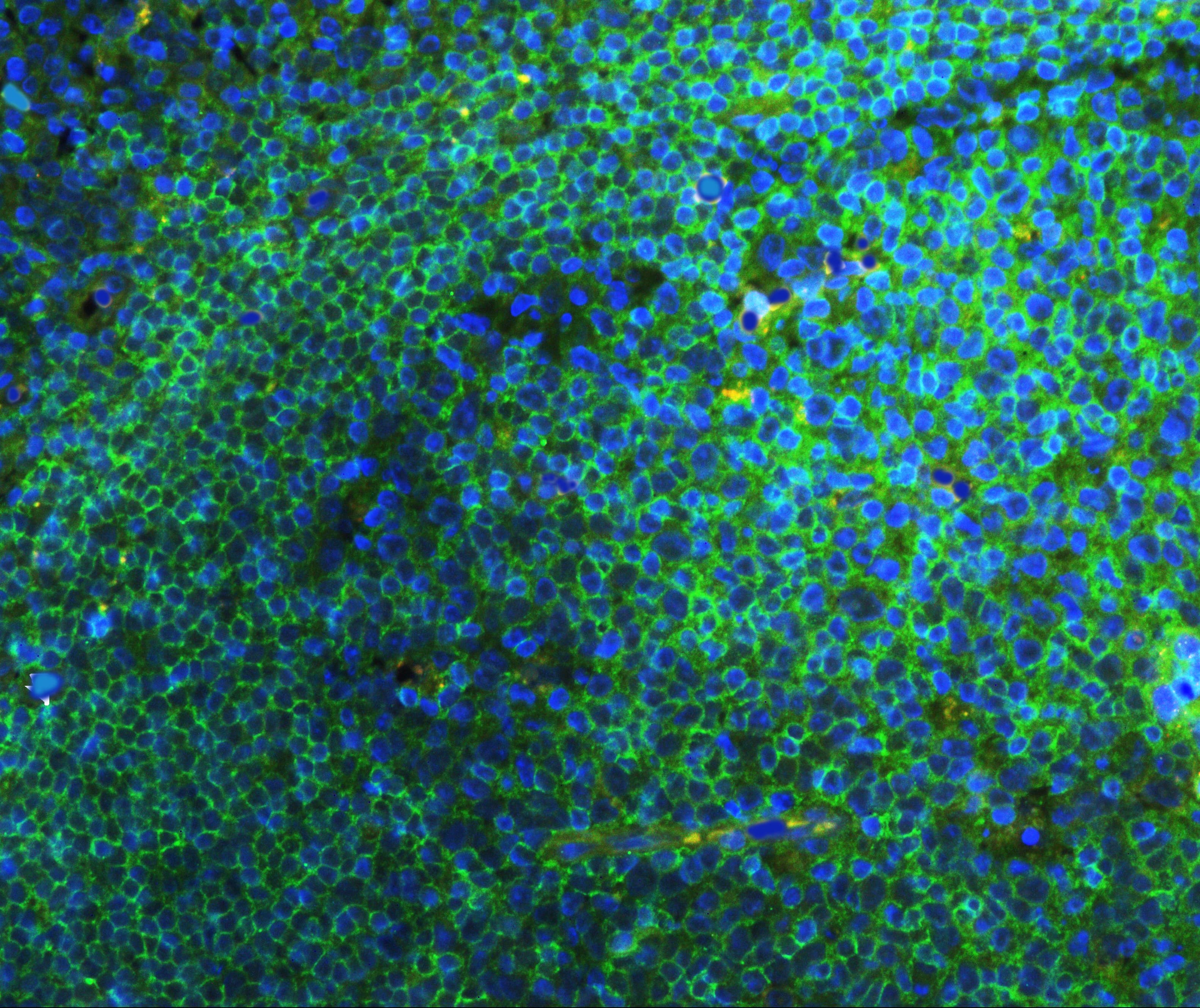 CD45 / LCA Antibody (aa1209-1227)