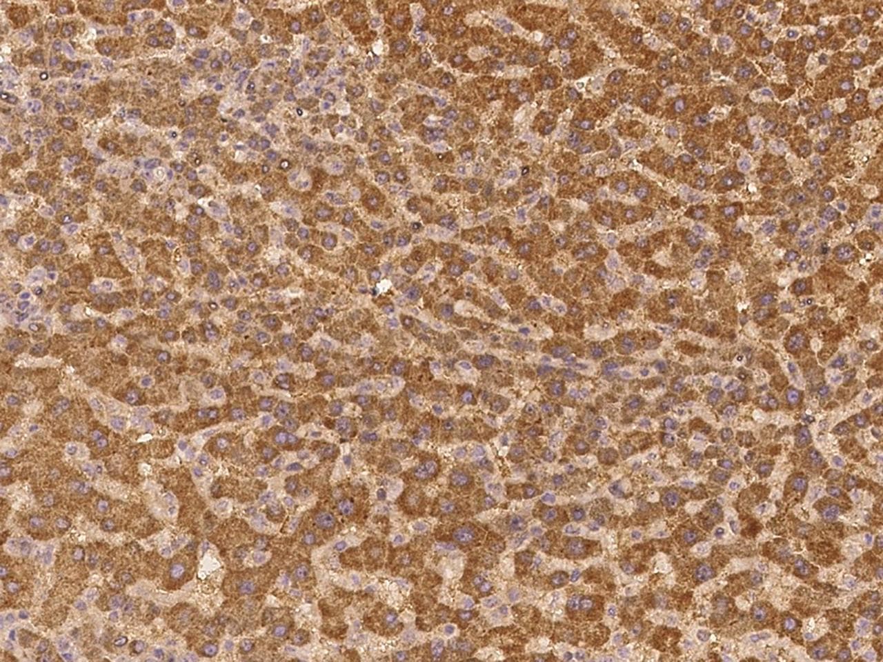 Polyclonal Rabbit anti-Human ABCG5 Antibody (IHC)