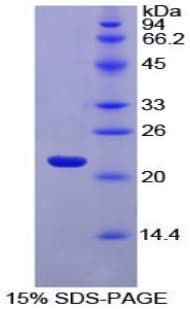 Horse FTL / Ferritin Light Chain Protein (Recombinant His)
