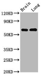 SELN / SEPN1 Antibody