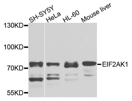 EIF2AK1 Antibody