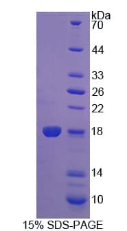 Human PDCD5 Protein (Recombinant His)