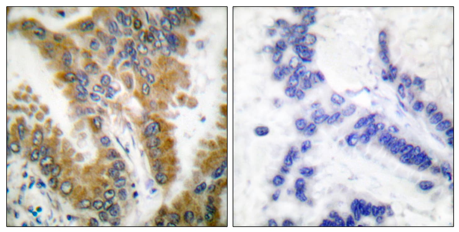 Polyclonal Rabbit anti-Human CRKL Antibody (aa173-222, IHC, IF, WB)