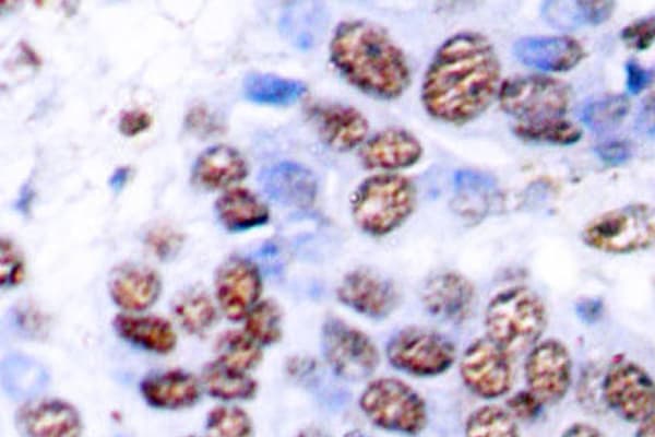 RELA / NFKB p65 Antibody (Met270)