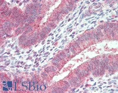 Polyclonal Rabbit anti-Human DIXDC1 Antibody (aa550-600, IHC)