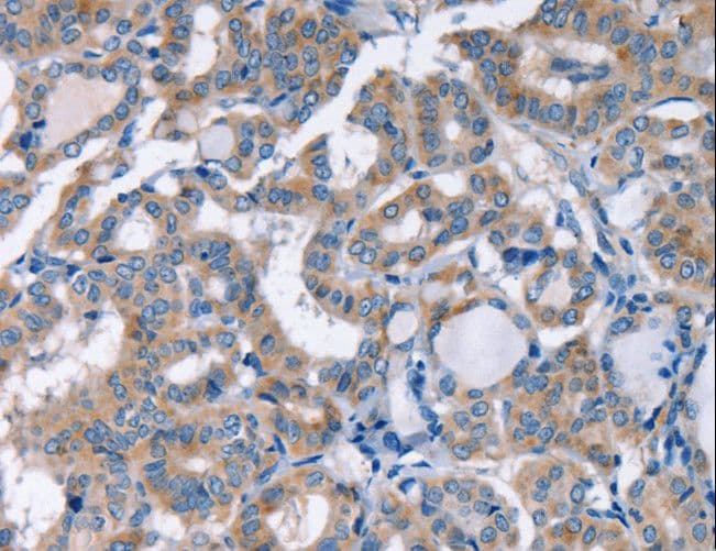 KCNQ5 Antibody