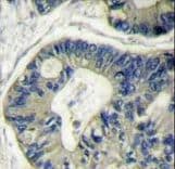 AKT2 Antibody (aa93-123)