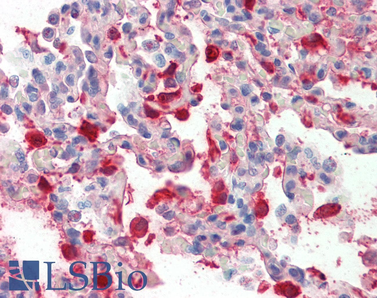 IHC-plus™ VTN / Vitronectin Antibody
