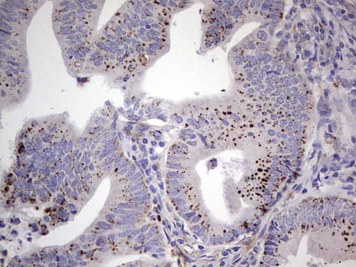 Monoclonal Mouse anti-Human PLAU / Urokinase / uPA Antibody (clone OTI5H4, aa107-379, IHC, WB)