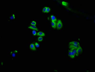 GRM2 / MGLUR2 Antibody