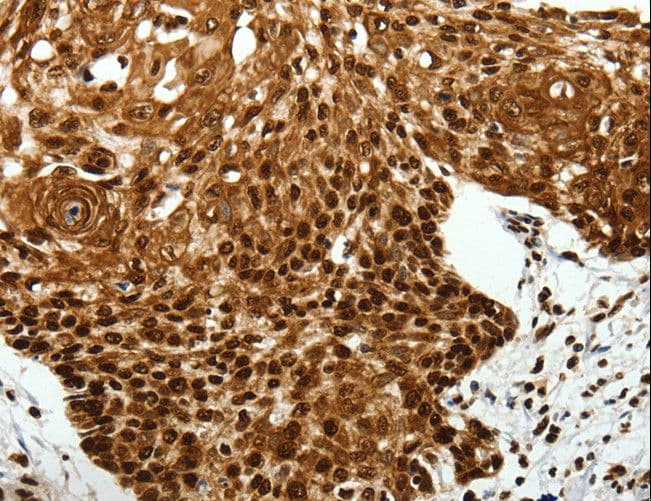 SCN1A / Nav1.1 Antibody