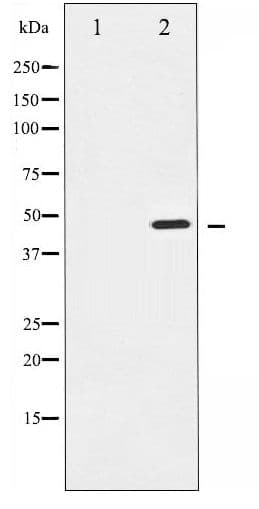 AURKA / Aurora-A Antibody (phospho-Thr288)