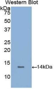 PKM / Pyruvate Kinase, Muscle Antibody (aa141-248)