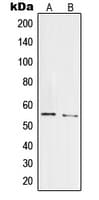 PRPF19 / PRP19 Antibody (Internal)