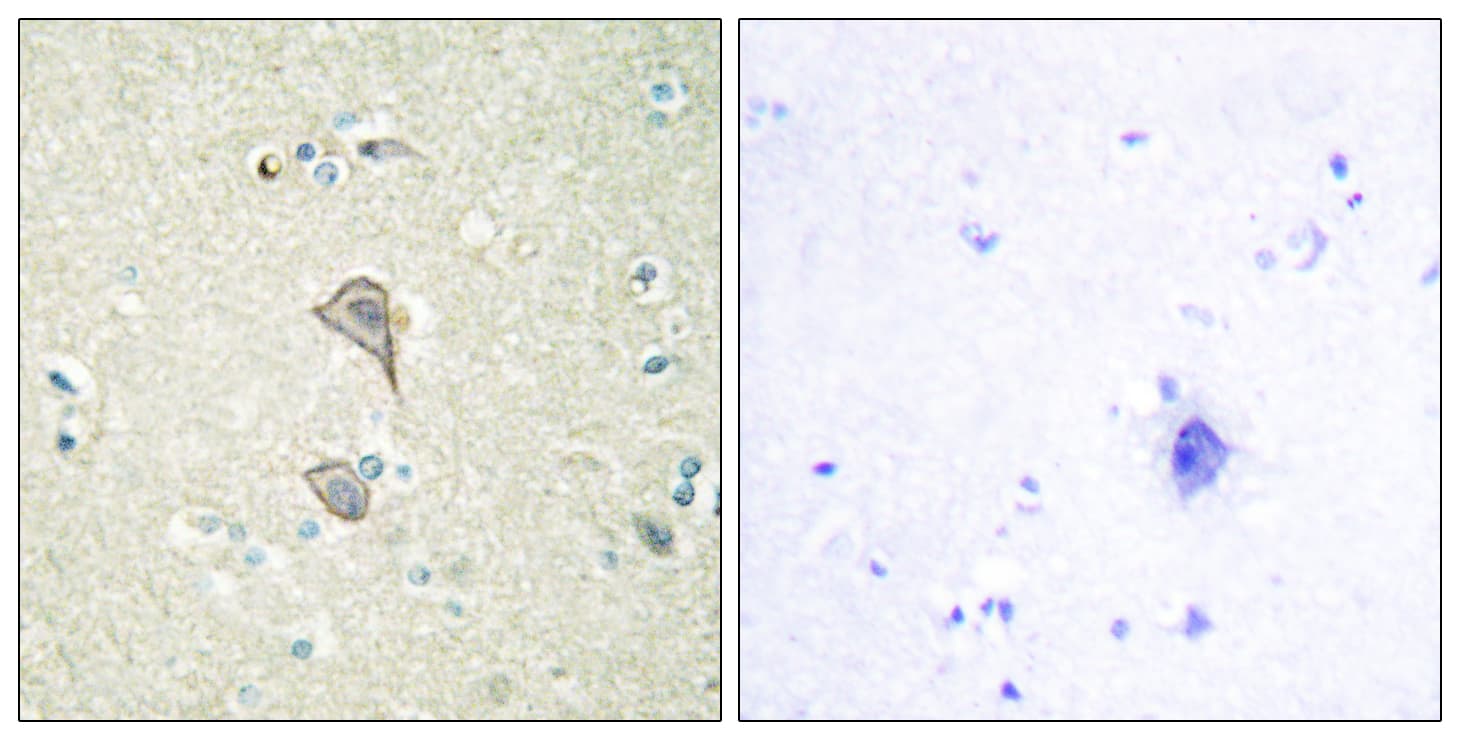 Polyclonal Rabbit anti-Human NKTR Antibody (aa784-833, IHC, IF)