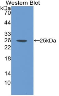 LAT Antibody (aa25-221)