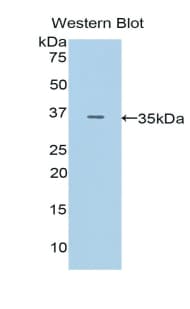 PAPPA / PAPP-A Antibody (aa1270-1558)