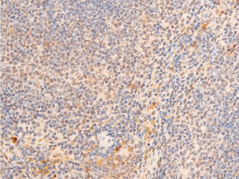 LMNA / Lamin A+C Antibody (phospho-Ser392)