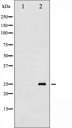CDKN1B / p27 Kip1 Antibody (phospho-Ser10)
