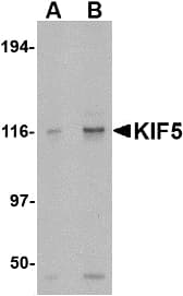 Polyclonal Rabbit anti-Human Kinesin 5A / KIF5A Antibody (IHC, IF, WB)