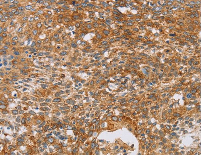 Polyclonal Rabbit anti-Human CRELD2 Antibody (IHC, WB)