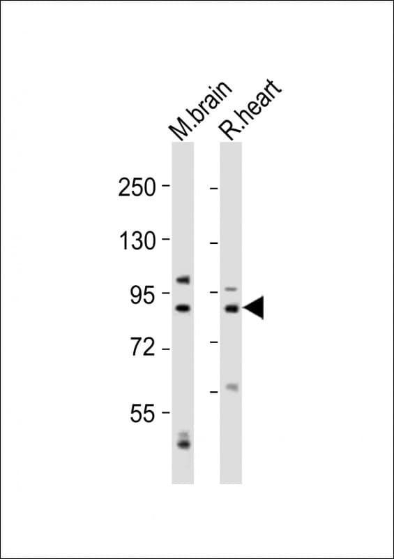 CAPN5 / Calpain 5 Antibody (aa297-331)