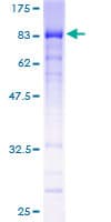 Human HINFP Protein (Recombinant GST)